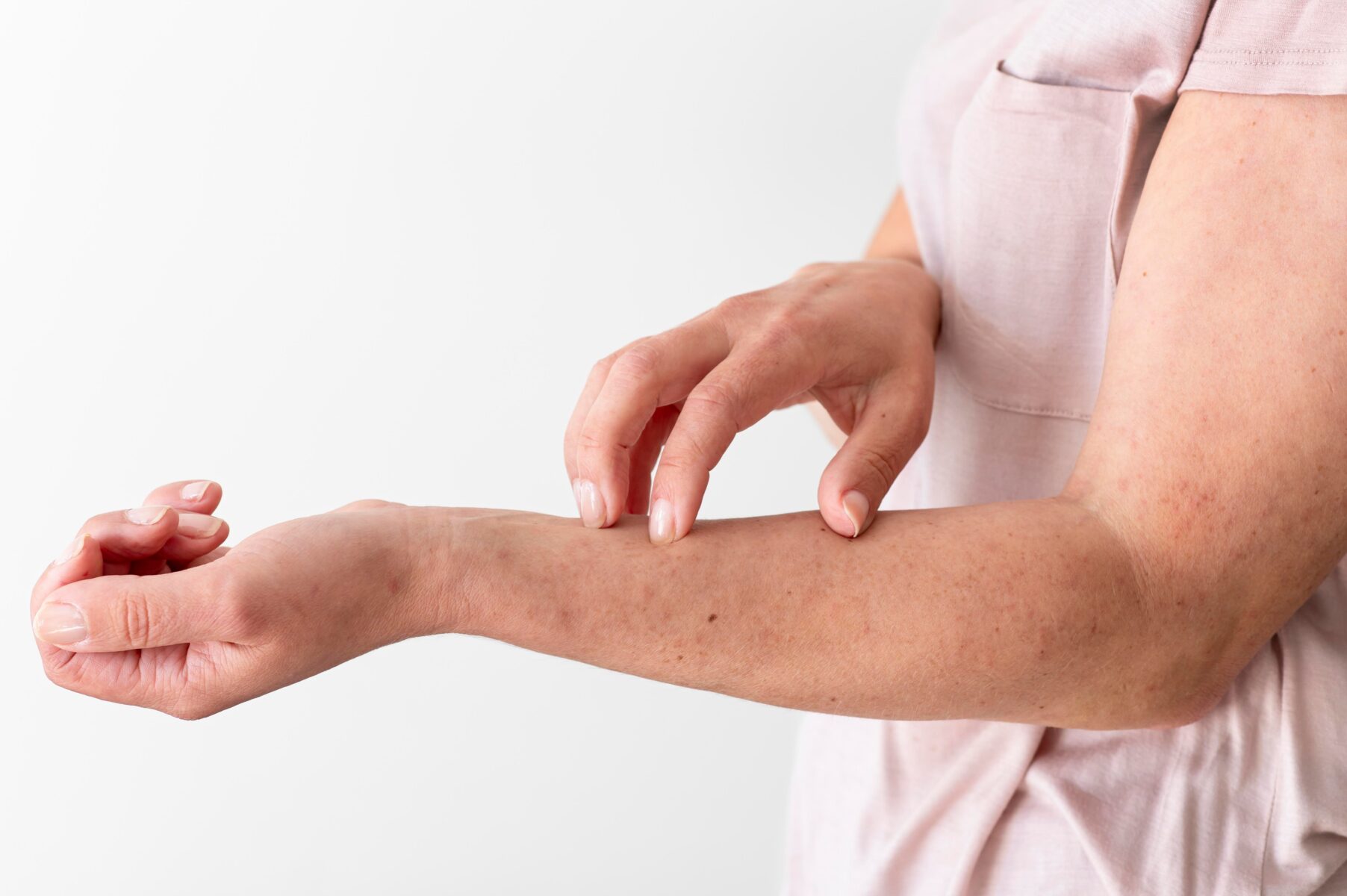 Cómo cuidar la piel atópica