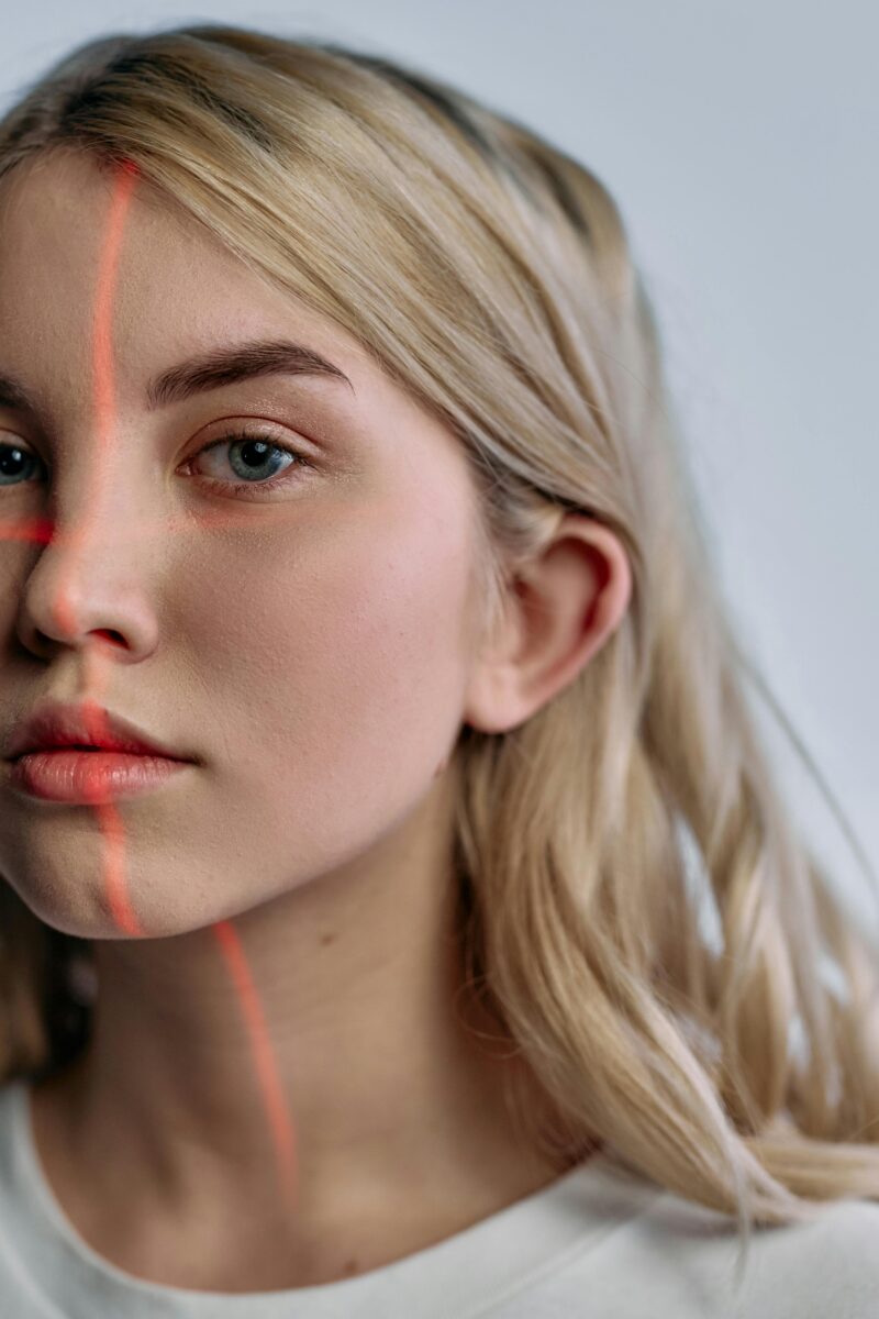 IPL, peeling, endoláser